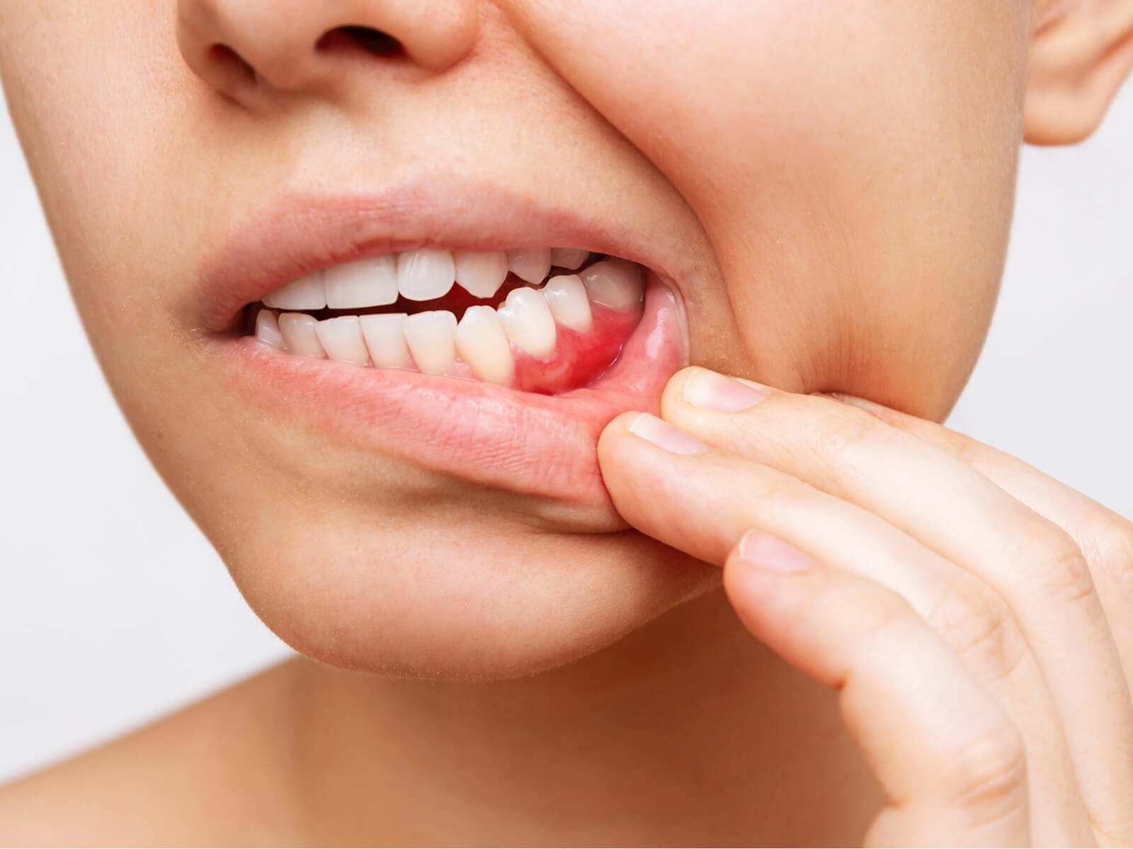 What Causes A Swollen Gum Around One Tooth?