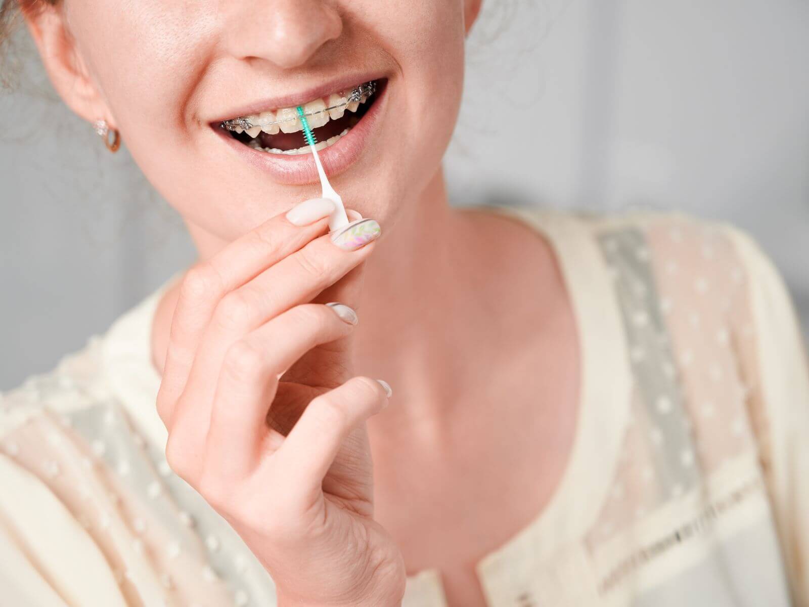 How To Take Care of Braces: Precautions And Tips