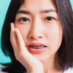 Top 5 Causes Of Bleeding Gums That Everyone Should Know