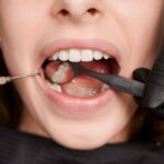 Why Regular Oral Cancer Screenings Should Be Part of Your Annual Dental Checkup